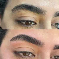 اصلاح صورت