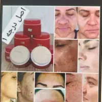 کرم معجزه اصل