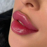 فیلر لب ژل گونه فک بوتاکس لیزرساکشن غبغب کاشت مو|خدمات آرایشگری و زیبایی|رشت, گلسار|دیوار