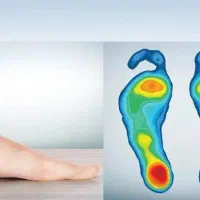 خدمات تخصصی اسکن کف پا