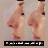 انجام تمام خدمات فیلر|خدمات آرایشگری و زیبایی|شهرکرد, |دیوار