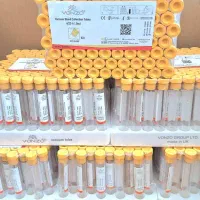 لوله شیشه ای ونزو انگلستان