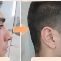 کرم ضد لک و روشن کننده پوست (بیوممتیک)