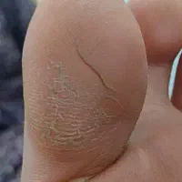 پدیکوروکف سابی پا. پاکسازی دست وپا قوزک ارنج وزانو|خدمات آرایشگری و زیبایی|جیرفت, |دیوار