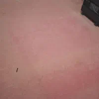 موکت کار کرده|موکت|اردبیل, |دیوار