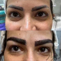 کاشت مو و ابرو با جدید ترین دستگاه های روز دنیا|خدمات آرایشگری و زیبایی|یاسوج, |دیوار