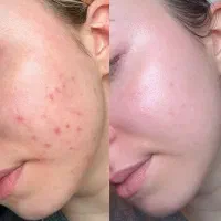 پوستتو شفاف و آیینه کن