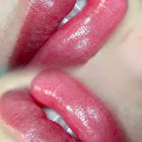 فیبروز میکروشیدلب از1500