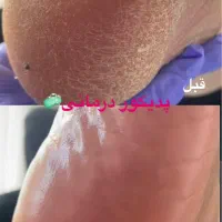 پدیکور با۲۰٪تخفیف|خدمات آرایشگری و زیبایی|ارومیه, |دیوار