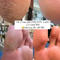 کاشت ناخن ، اسپا ،پارافین تراپی و آموزش همه موارد|خدمات آرایشگری و زیبایی|شیراز, معالی‌آباد|دیوار