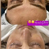 پاکسازی،فیشال درمان مشکلات پوستی|خدمات آرایشگری و زیبایی|زابل, |دیوار