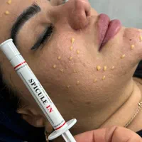 فشیال و پاکسازی پوست همراه با آموزش زیر نظر پزشک|خدمات آرایشگری و زیبایی|اصفهان, مسجد مصلی|دیوار