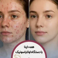 لیزر تخصصی موهای زاید رفع مشکلات پوست پاک کردن تتو|خدمات آرایشگری و زیبایی|شیراز, حافظیه|دیوار