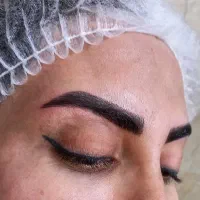 میکروبلیدینگ حرفه ای تخفیف ویژه