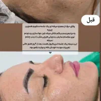پاکسازی پوست و فیشیال تخصصی