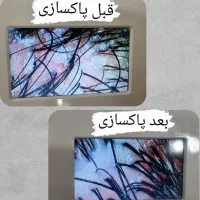 درمان ریزش مو،پوسته،شوره،خارش و بیماری های قارچی|خدمات آرایشگری و زیبایی|شیراز, شهرک امیر کبیر|دیوار