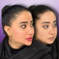 تخفیفات ژل وبوتاکس ومزوژل به مناسبت یلدا|خدمات آرایشگری و زیبایی|قم, زنبیل آباد|دیوار