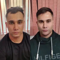 ژل بوتاکس فیلر آنزیم خالبرداری با تخفیف ویژه|خدمات آرایشگری و زیبایی|تهران, سبلان (لشگر)|دیوار