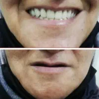 دندانسازی ایده آل