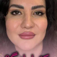 آموزش تخصصی و درمانی ژل و بوتاکس|خدمات آموزشی|اصفهان, مهدی آباد|دیوار