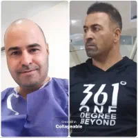 کاشت مو ،ابرو ،ریش ،پی آر پی و مزوتراپی