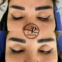 بوتاکس ، فیلر ،ژل ،مزو با تخفیفات ویژه|خدمات زیبایی و سلامت|تبریز, |دیوار
