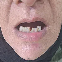 ساخت دندان|خدمات آرایشگری و زیبایی|خرمدره, |دیوار