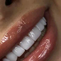 جشنواره دندانپزشکی پاییزی