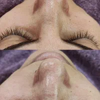 لیزر هایفو ژل بوتاکس ریمو تتو|خدمات آرایشگری و زیبایی|بوشهر, |دیوار