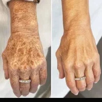 تضمینی صورتتو شفاف کن