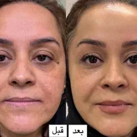 جراحی و زیبایی صورت و بدن، مزو، بوتاکس، چربی، فیلر|خدمات آرایشگری و زیبایی|کرمانشاه, |دیوار