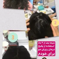 درمان ریزش مو و رویش مجدد مو