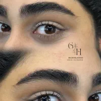 میکروبلیدینگ