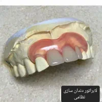 دندانسازی وساخت دندان بدون کام|آرایشی، بهداشتی، درمانی|زابل, |دیوار