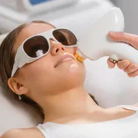 لیزر موهای زائد