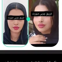 تزریق چربی، بلفاروپلاستی پلک، بینی اتوپلاستی گوش|خدمات آرایشگری و زیبایی|تهران, ستارخان|دیوار