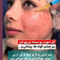 آموزش خدمات زیبایی  تزریق ژل .فیلر .بوتاکس .چربی|خدمات آموزشی|رشت, گلسار|دیوار