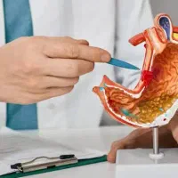 راهنمایی (لطفا بخوانید) شدید توصیه میشه