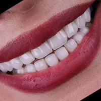 دندانپزشکی، لمینت،ایمپلنت ،دیجیتال،نقدواقساط|خدمات آرایشگری و زیبایی|مشهد, سناباد|دیوار