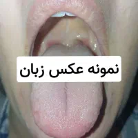 سونوگرافی از روی زبان|خدمات آرایشگری و زیبایی|کرمانشاه, |دیوار