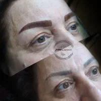 میکروبلیدینگ شیدینگ لب رژلب دائم بنمژه ریموو تتو