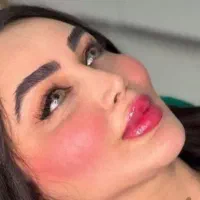 فیلر ژل لب بوتاکس تخصصی پزشک کلینیک تهرانسر|خدمات آرایشگری و زیبایی|اسلام‌شهر, باغ فیض|دیوار