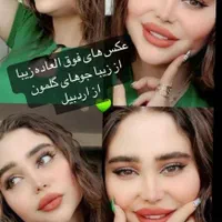 تزریق واموزش ژل بوتاکس مزوتراپی لیفت نخ...|خدمات آرایشگری و زیبایی|کرمانشاه, |دیوار