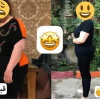 اضافه وزن وپوست آسیب دیده از شما ولاغری از ما