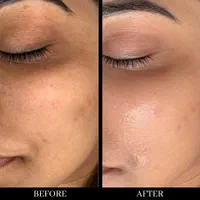 فیشیال و پاکسازی|خدمات آرایشگری و زیبایی|مشهد, اقبال|دیوار