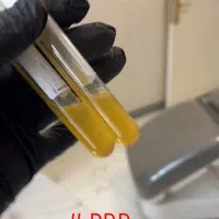 پی ار پی برای جوانسازی صورت، قطع ریزش مو، prp رشت|خدمات آرایشگری و زیبایی|رشت, گلسار|دیوار