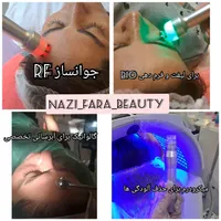 مدل کربوفیشیال(کربن تراپی+فیشال+پلاژن) کلینیکی|خدمات آرایشگری و زیبایی|تهران, گاندی|دیوار