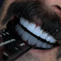 دندانپزشکی زیبایی در کهنوج