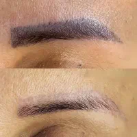 ریمو تتوهای قدیمی ابرو و خط چشم