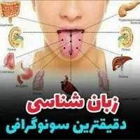 راهکار و درمان تضمینی کبدعفونت زگیل جوش|خدمات آرایشگری و زیبایی|مشهد, بهار|دیوار